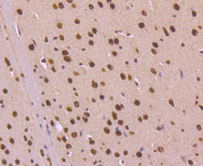 Paraformaldehyde-fixed and paraffin-embedded Mouse brain tissue incubated with KAP1 (7C5) Monoclonal Antibody (bsm-52679R) at 1:100, overnight at 4°C, followed by a conjugated secondary antibody and DAB staining. Counterstained with hematoxylin.