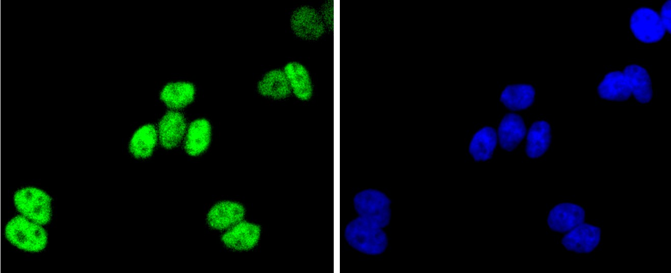 IF(ICC) staining with JunB (2C1) Monoclonal Antibody (bsm-52681R) at 1:100 in HeLa cells (green). The nuclear counterstain is DAPI (blue). Cells were fixed in paraformaldehyde, permeabilized with 0.25% Triton X100/PBS.