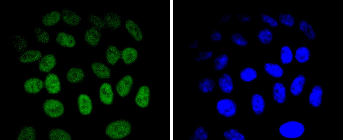 IF(ICC) staining with JunB (2C1) Monoclonal Antibody (bsm-52681R) at 1:100 in HepG2 cells (green). The nuclear counterstain is DAPI (blue). Cells were fixed in paraformaldehyde, permeabilized with 0.25% Triton X100/PBS.