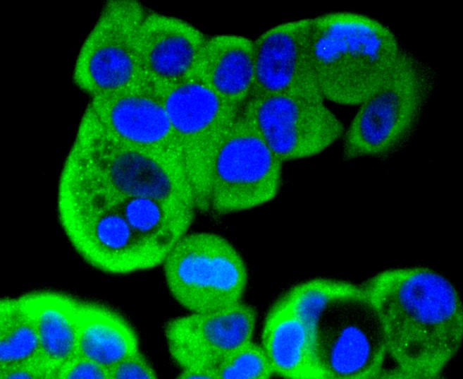 IF(ICC) staining with MEK2 (2C1) Monoclonal Antibody (bsm-52684R) at 1:300 in MCF-7 cells (green). The nuclear counterstain is DAPI (blue). Cells were fixed in paraformaldehyde, permeabilized with 0.25% Triton X100/PBS.