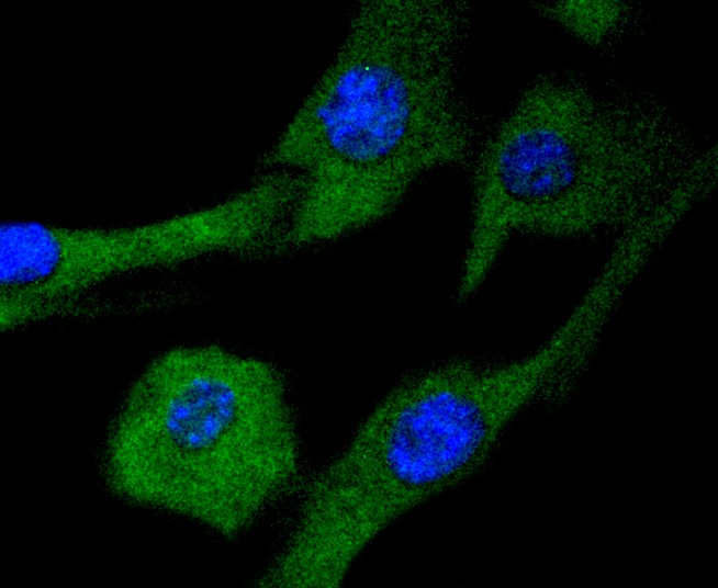 IF(ICC) staining with MEK2 (2C1) Monoclonal Antibody (bsm-52684R) at 1:300 in NIH/3T3 cells (green). The nuclear counterstain is DAPI (blue). Cells were fixed in paraformaldehyde, permeabilized with 0.25% Triton X100/PBS.