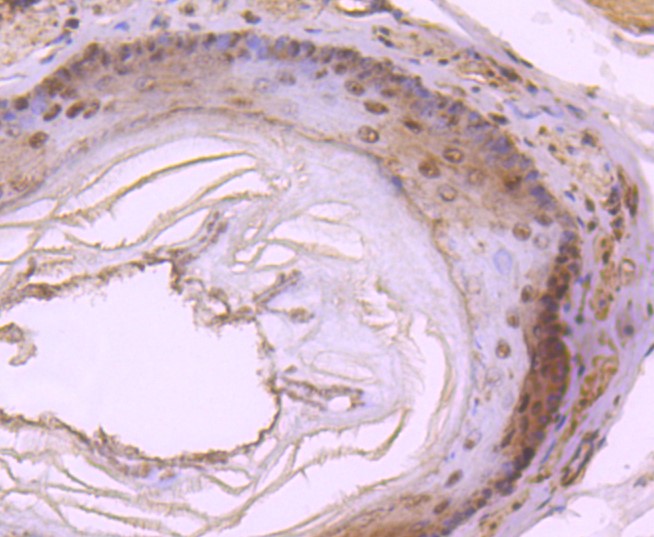 Paraformaldehyde-fixed and paraffin-embedded Rat esophagus tissue incubated with DYNLL1 (9T1) Monoclonal Antibody (bsm-52688R) at 1:100, overnight at 4°C, followed by a conjugated secondary antibody and DAB staining. Counterstained with hematoxylin.