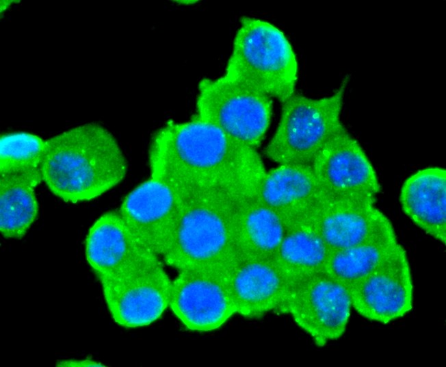 IF(ICC) staining with Tyrosine Hydroxylase (3T1) Monoclonal Antibody (bsm-52689R) at 1:300 in N2A cells (green). The nuclear counterstain is DAPI (blue). Cells were fixed in paraformaldehyde, permeabilized with 0.25% Triton X100/PBS.