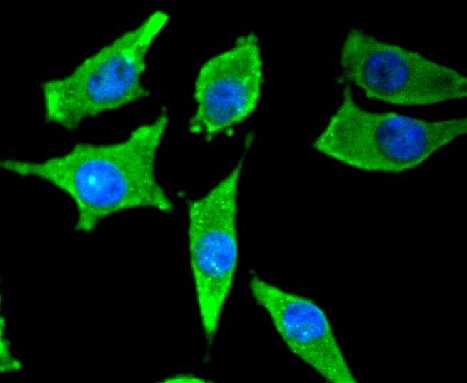 IF(ICC) staining with Tyrosine Hydroxylase (3T1) Monoclonal Antibody (bsm-52689R) at 1:300 in SH-SY5Y cells (green). The nuclear counterstain is DAPI (blue). Cells were fixed in paraformaldehyde, permeabilized with 0.25% Triton X100/PBS.