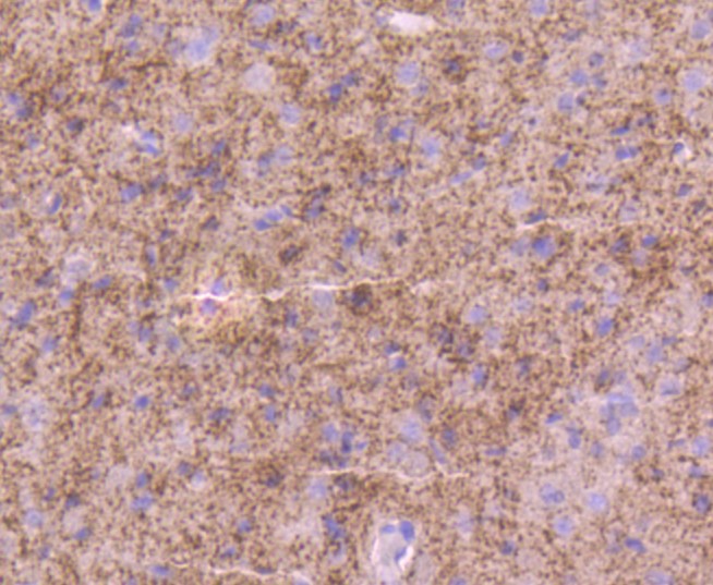 Paraformaldehyde-fixed and paraffin-embedded Rat brain tissue incubated with Tyrosine Hydroxylase (3T1) Monoclonal Antibody (bsm-52689R) at 1:100, overnight at 4°C, followed by a conjugated secondary antibody and DAB staining. Counterstained with hematoxylin.