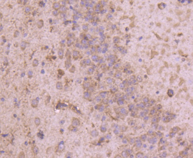 Paraformaldehyde-fixed and paraffin-embedded Mouse brain tissue incubated with Tyrosine Hydroxylase (3T1) Monoclonal Antibody (bsm-52689R) at 1:100, overnight at 4°C, followed by a conjugated secondary antibody and DAB staining. Counterstained with hematoxylin.