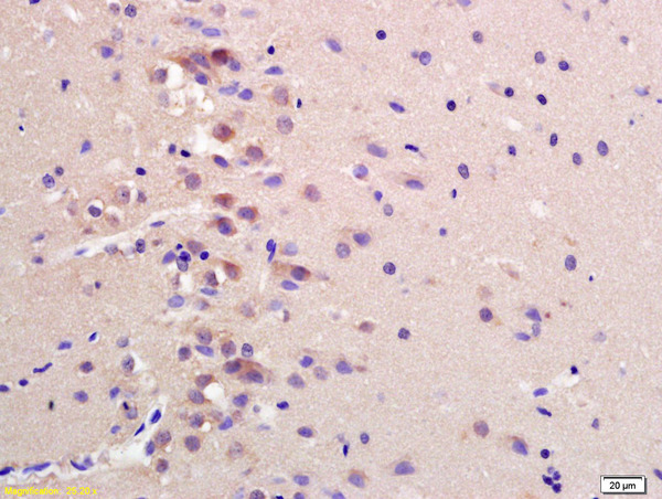 Formalin-fixed and paraffin embedded rat brain labeled with Anti-CCDC61 Polyclonal Antibody, Unconjugated (bs-8136R) at 1:200 followed by conjugation to the secondary antibody and DAB staining Formalin-fixed and paraffin embedded rat brain labeled with Anti-CCDC61 Polyclonal Antibody, Unconjugated (bs-8136R) at 1:200 followed by conjugation to the secondary antibody and DAB staining