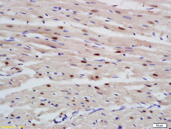 Formalin-fixed and paraffin embedded rat heart labeled with Anti-RBM20 Polyclonal Antibody, Unconjugated (bs-9606R) at 1:200 followed by conjugation to the secondary antibody and DAB staining Formalin-fixed and paraffin embedded rat heart labeled with Anti-RBM20 Polyclonal Antibody, Unconjugated (bs-9606R) at 1:200 followed by conjugation to the secondary antibody and DAB staining
