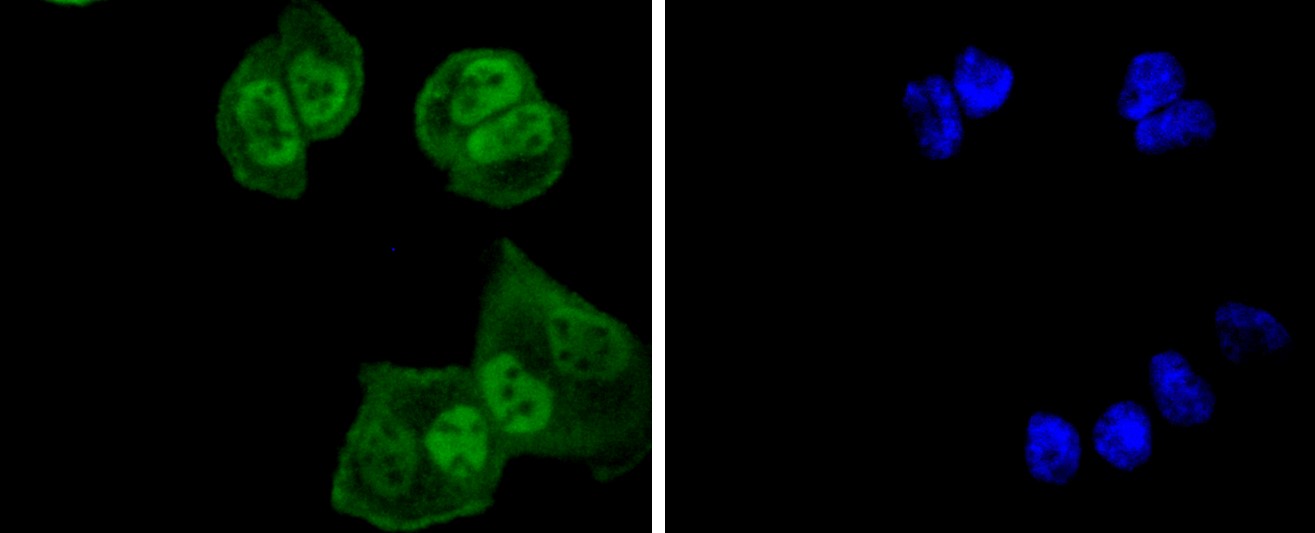 IF(ICC) staining with Ubiquitin-like modifier-activating enzyme 1 (8A4) Monoclonal Antibody (bsm-52695R) at 1:100 in HeLa cells (green). The nuclear counterstain is DAPI (blue). Cells were fixed in paraformaldehyde, permeabilized with 0.25% Triton X100/PBS.