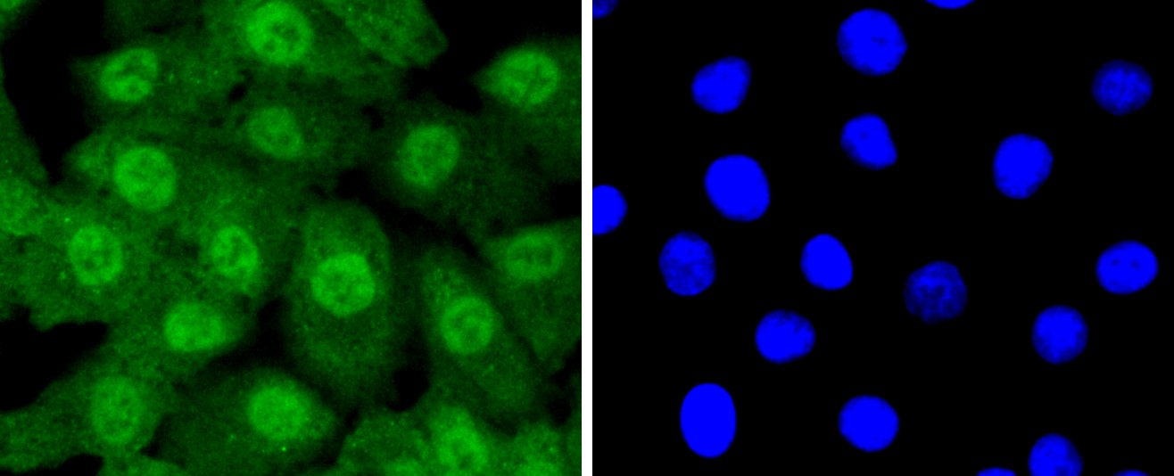 IF(ICC) staining with Ubiquitin-like modifier-activating enzyme 1 (8A4) Monoclonal Antibody (bsm-52695R) at 1:100 in A549 cells (green). The nuclear counterstain is DAPI (blue). Cells were fixed in paraformaldehyde, permeabilized with 0.25% Triton X100/PBS.