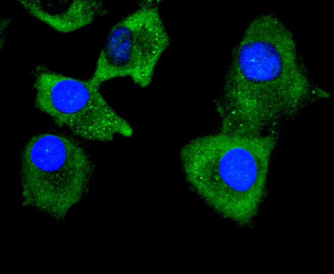 IF(ICC) staining with Collagen VI (9C1) Monoclonal Antibody (bsm-52703R) at 1:300 in A549 cells (green). The nuclear counterstain is DAPI (blue). Cells were fixed in paraformaldehyde, permeabilized with 0.25% Triton X100/PBS.