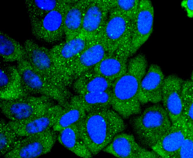 IF(ICC) staining with Collagen VI (9C1) Monoclonal Antibody (bsm-52703R) at 1:300 in HepG2 cells (green). The nuclear counterstain is DAPI (blue). Cells were fixed in paraformaldehyde, permeabilized with 0.25% Triton X100/PBS.