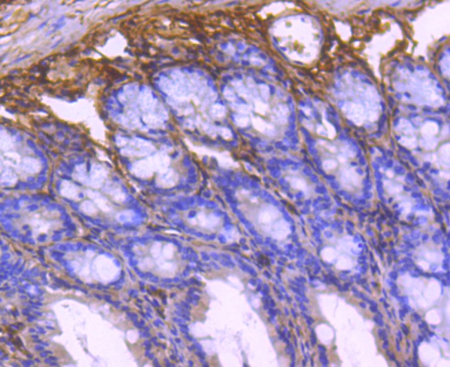 Paraformaldehyde-fixed and paraffin-embedded Mouse colon tissue incubated with Collagen VI (9C1) Monoclonal Antibody (bsm-52703R) at 1:100, overnight at 4°C, followed by a conjugated secondary antibody and DAB staining. Counterstained with hematoxylin.