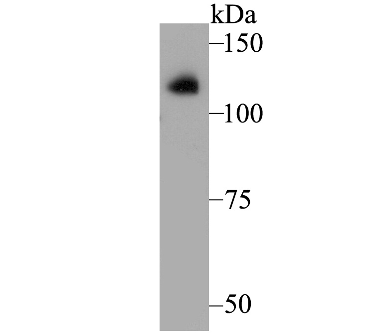 Lane 1: Human Fetal Skeletal Muscle; Probed with ATP2A1 (3G1) Monoclonal Antibody (bsm-54466R) at 1:500, overnight at 4°C followed by a conjugated secondary antibody for 60 minutes at 37°C.