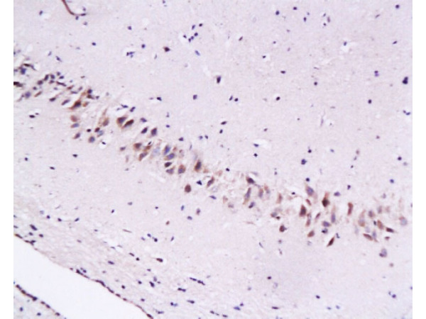 Formalin-fixed and paraffin embedded rat brain tissue labeled with Anti-Cygb Polyclonal Antibody (bs-0590R), Unconjugated at 1:200, followed by conjugation to the secondary antibody and DAB staining