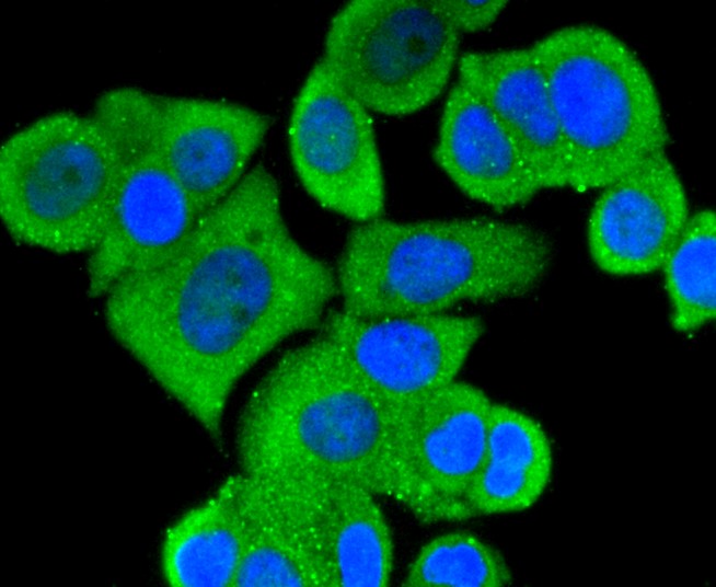 IF(ICC) staining with MEKK3 (5C1) Monoclonal Antibody (bsm-52709R) at 1:300 in MCF-7 cells (green). The nuclear counterstain is DAPI (blue). Cells were fixed in paraformaldehyde, permeabilized with 0.25% Triton X100/PBS.