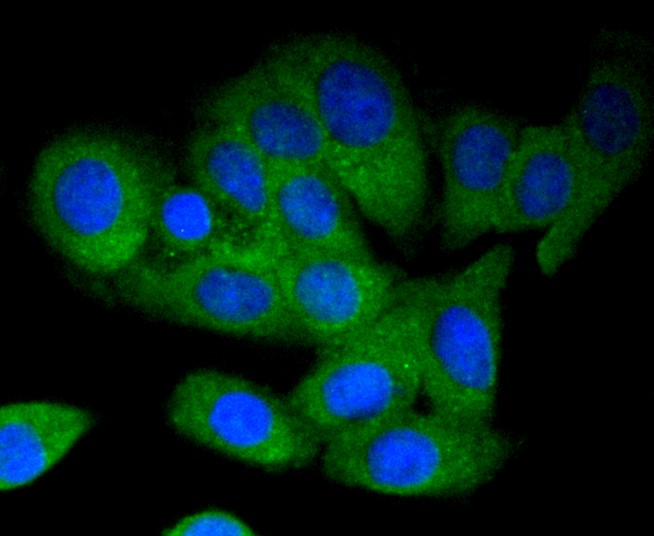 IF(ICC) staining with MEKK3 (5C1) Monoclonal Antibody (bsm-52709R) at 1:300 in SKOV-3 cells (green). The nuclear counterstain is DAPI (blue). Cells were fixed in paraformaldehyde, permeabilized with 0.25% Triton X100/PBS.