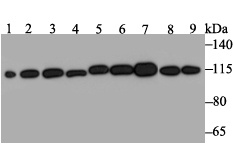 Lane 1: Mouse testis; Lane 2: Rat brain; Lane 3: A431 Cells; Lane 4: SH-SY-5Y Cells; Lane 5: SiHa Cells; Lane 6: 293 Cells; Lane 7: Hela Cells; Lane 8: HepG2 Cells; Lane 9: A549 Cells; Probed with RNF40 (8D8) Monoclonal Antibody (bsm-54467R) at 1:1000, overnight at 4°C followed by a conjugated secondary antibody for 60 minutes at 37°C.