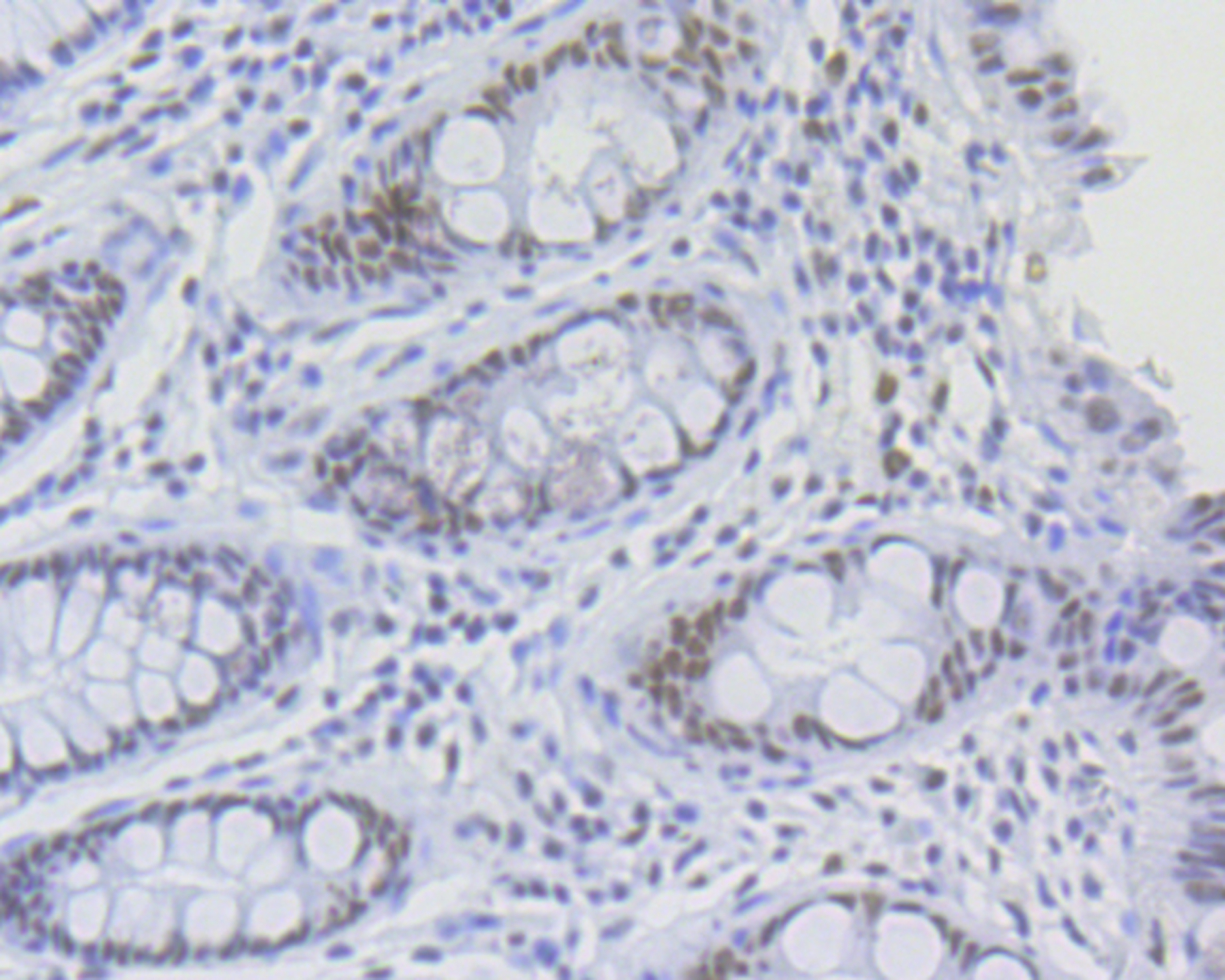 Paraformaldehyde-fixed and paraffin-embedded Human Tonsil tissue incubated with RNF40 (8D8) Monoclonal Antibody (bsm-54467R) at 1:100, overnight at 4°C, followed by a conjugated secondary antibody and DAB staining. Counterstained with hematoxylin. The tissue was pre-treated using heat mediated antigen retrieval with sodium citrate buffer (pH6) for 20 mins.