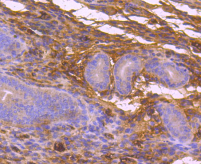 Paraformaldehyde-fixed and paraffin-embedded Mouse uterus tissue incubated with MEKK3 (5C1) (6F5) Monoclonal Antibody (bsm-52709R) at 1:100, overnight at 4°C, followed by a conjugated secondary antibody and DAB staining. Counterstained with hematoxylin.