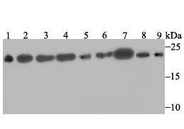 Lane 1: Mouse testis; Lane 2: Rat brain; Lane 3: A431 Cells; Lane 4: SH-SY-5Y Cells; Lane 5: SiHa Cells; Lane 6: 293 Cells; Lane 7: Hela Cells; Lane 8: HepG2 Cells; Lane 9: A549 Cells; Probed with SFRS3 (9C11) Monoclonal Antibody (bsm-54467R) at 1:500, overnight at 4°C followed by a conjugated secondary antibody for 60 minutes at 37°C.