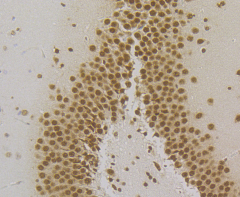 Paraformaldehyde-fixed and paraffin-embedded Rat Brain tissue incubated with SFRS3 (9C11) Monoclonal Antibody (bsm-54467R) at 1:200, overnight at 4°C, followed by a conjugated secondary antibody and DAB staining. Counterstained with hematoxylin. The tissue was pre-treated using heat mediated antigen retrieval with Tris-EDTA buffer (pH 8.0-8.4) for 20 minutes.