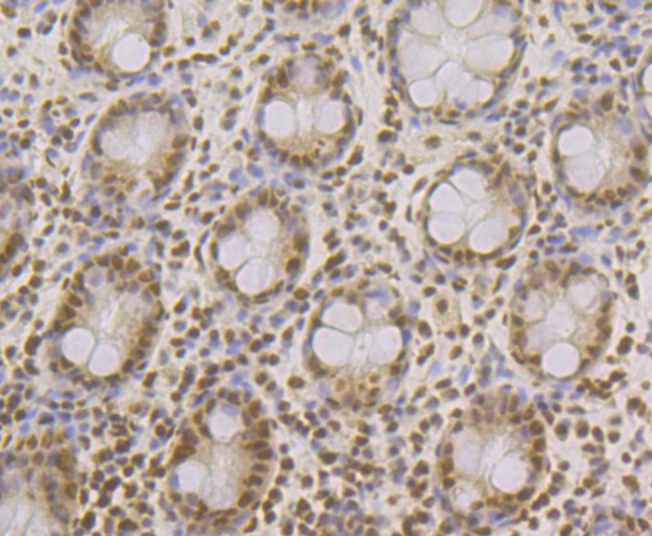 Paraformaldehyde-fixed and paraffin-embedded Human Colon tissue incubated with SFRS3 (9C11) Monoclonal Antibody (bsm-54467R) at 1:200, overnight at 4°C, followed by a conjugated secondary antibody and DAB staining. Counterstained with hematoxylin. The tissue was pre-treated using heat mediated antigen retrieval with Tris-EDTA buffer (pH 8.0-8.4) for 20 minutes.