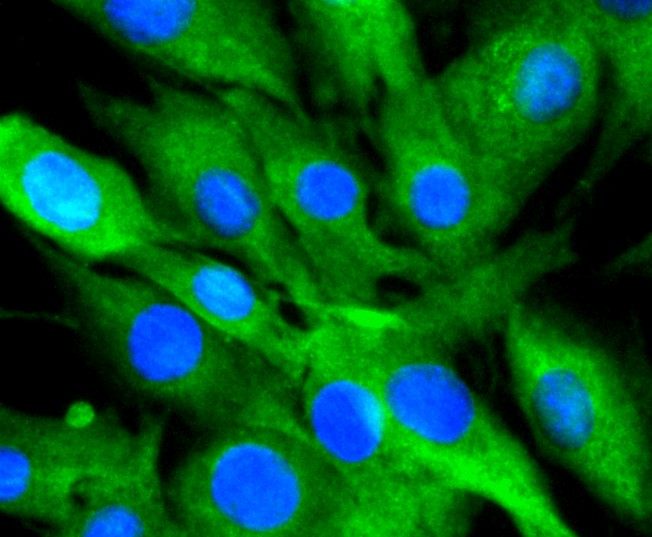 IF(ICC) staining with 14-3-3 alpha+beta (3C5) Monoclonal Antibody (bsm-52710R) at 1:300 in SHG-44 cells (green). The nuclear counterstain is DAPI (blue). Cells were fixed in paraformaldehyde, permeabilized with 0.25% Triton X100\/PBS.