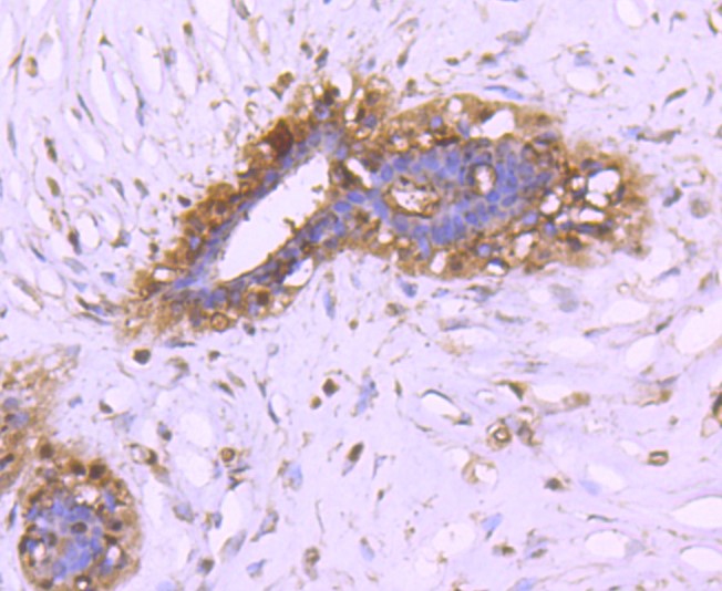 Paraformaldehyde-fixed and paraffin-embedded Human breast tissue incubated with 14-3-3 alpha+beta (3C5) Monoclonal Antibody (bsm-52710R) at 1:100, overnight at 4\u00b0C, followed by a conjugated secondary antibody and DAB staining. Counterstained with hematoxylin.