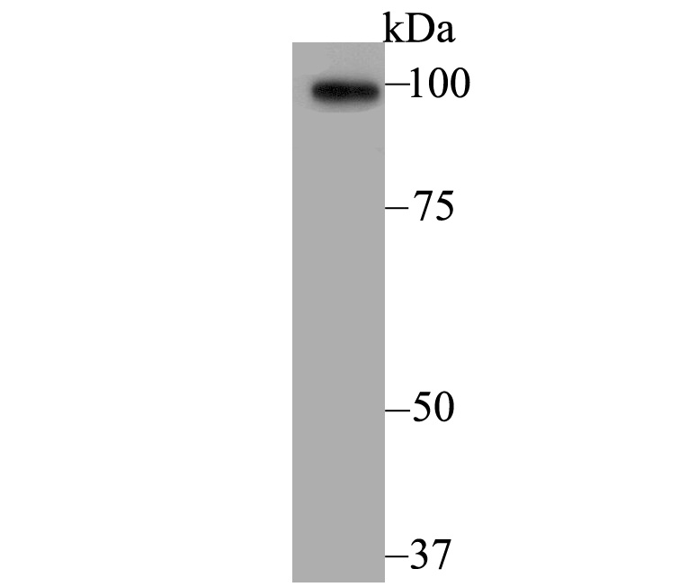 ACTN2 (7G3) Monoclonal Antibody