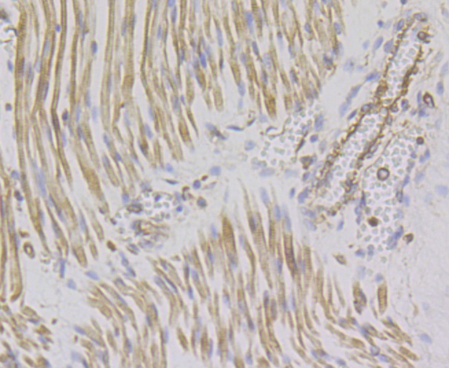 ACTN2 (7G3) Monoclonal Antibody