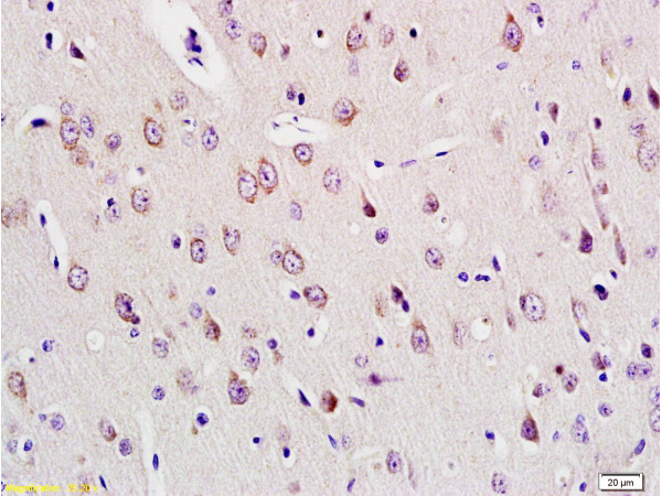 Formalin-fixed and paraffin embedded rat brain tissue labeled with Anti-E2F1 Polyclonal Antibody (bs-0599R), Unconjugated at 1:200, followed by conjugation to the secondary antibody and DAB staining