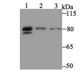 Lane 1: Rat Brain; Lane 2: A431 Cells; Lane 3: 293 Cells; Probed with MARK3 (2F7) Monoclonal Antibody (bsm-54462R) at 1:500, overnight at 4°C followed by a conjugated secondary antibody for 60 minutes at 37°C.