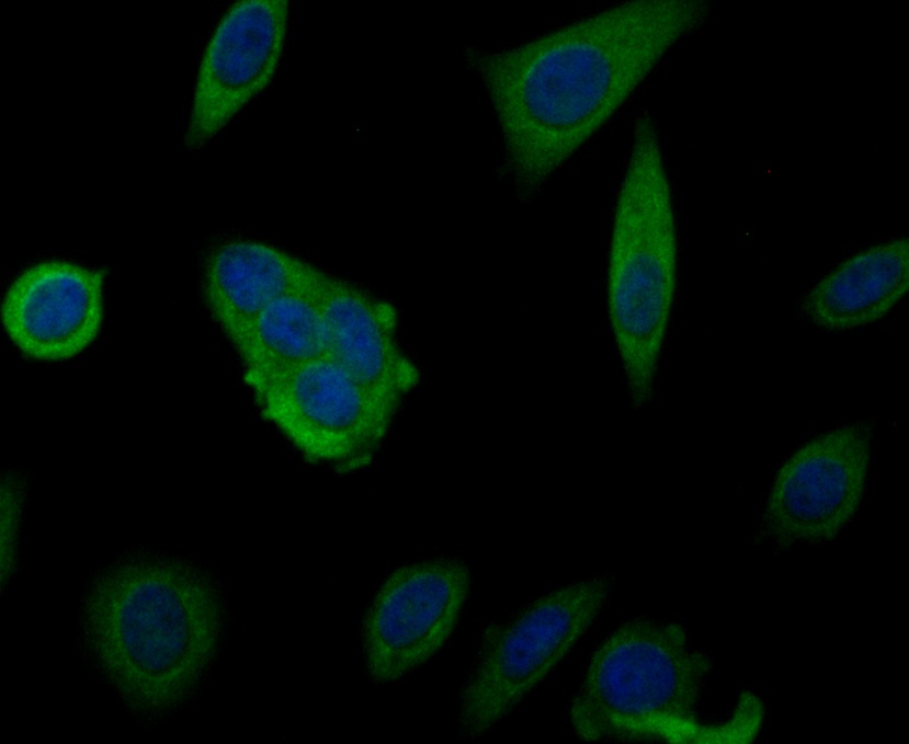 IF(ICC) staining with MARK3 (2F7) Monoclonal Antibody (bsm-54462R) at 1:100 in MCF-7 cells (green). The nuclear counterstain is DAPI (blue). Cells were fixed in paraformaldehyde, permeabilized with 0.1% Triton X100/TBS for 10 mins at room temperature.