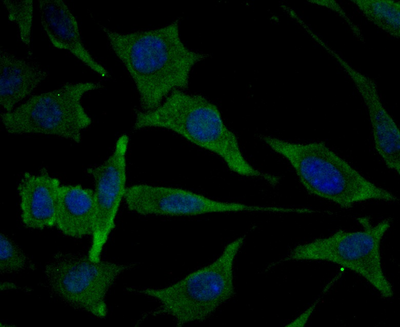 IF(ICC) staining with MARK3 (2F7) Monoclonal Antibody (bsm-54462R) at 1:100 in SH-SY5Y cells (green). The nuclear counterstain is DAPI (blue). Cells were fixed in paraformaldehyde, permeabilized with 0.1% Triton X100/TBS for 10 mins at room temperature.