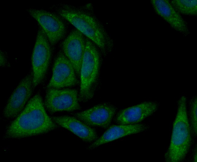 IF(ICC) staining with MARK3 (2F7) Monoclonal Antibody (bsm-54462R) at 1:100 in SiHa cells (green). The nuclear counterstain is DAPI (blue). Cells were fixed in paraformaldehyde, permeabilized with 0.1% Triton X100/TBS for 10 mins at room temperature.