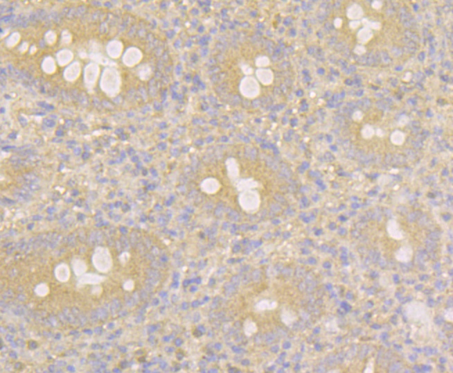 Paraformaldehyde-fixed and paraffin-embedded Human Appendix tissue incubated with MARK3 (2F7) Monoclonal Antibody (bsm-54462R) at 1:100, overnight at 4°C, followed by a conjugated secondary antibody and DAB staining. Counterstained with hematoxylin. The tissue was pre-treated using heat mediated antigen retrieval with Tris-EDTA buffer (pH 8.0-8.4) for 20 minutes.