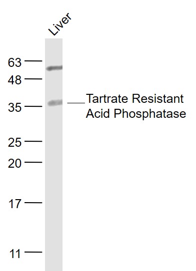 Lane 1: Mouse Liver; Probed with Tartrate Resistant Acid Phosphatase Polyclonal Antibody, Unconjugated (bs-6434R) at 1:300, overnight at 4°C followed by incubation with a conjugated secondary antibody for 60 minutes at 37°C.