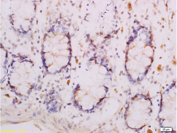 Formalin-fixed and paraffin embedded human rectal tissue labeled with Anti-Adiponectin Receptor 1 Polyclonal Antibody (bs-0610R), Unconjugated at 1:300, followed by conjugation to the secondary antibody and DAB staining