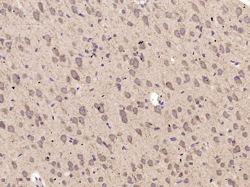 Paraformaldehyde-fixed, paraffin-embedded Rat Brain tissue; Antigen retrieval by boiling in sodium citrate buffer (0.01M, pH6) for 15 minutes; Block endogenous peroxidase by 3% hydrogen peroxide for 30 minutes; Blocking buffer (3% BSA) at RT for 20 minutes; Antibody incubation with ABCG1 Polyclonal Antibody, Unconjugated (bs-1231R) at 1:400 overnight at 4°C, followed by incubation with a conjugated secondary antibody, DAB and counterstaining.