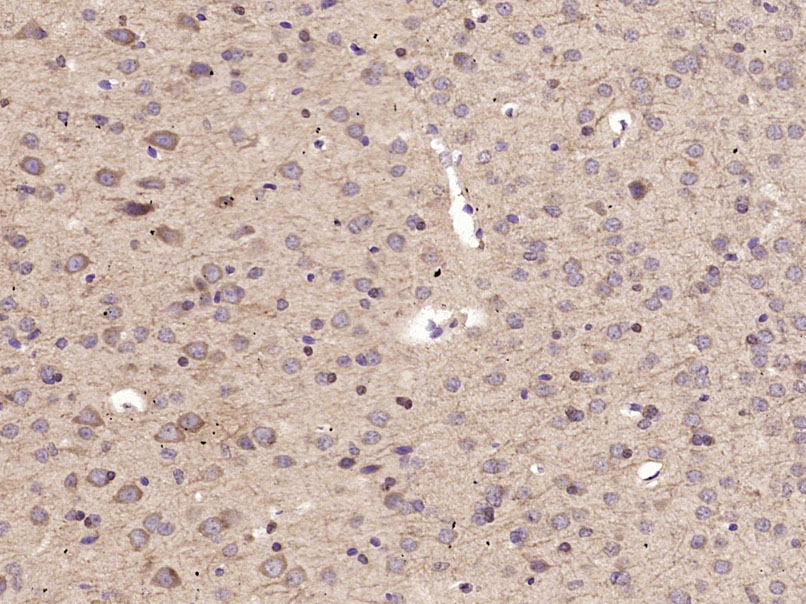 Paraformaldehyde-fixed, paraffin-embedded Mouse Brain tissue; Antigen retrieval by boiling in sodium citrate buffer (0.01M, pH6) for 15 minutes; Block endogenous peroxidase by 3% hydrogen peroxide for 30 minutes; Blocking buffer (3% BSA) at RT for 20 minutes; Antibody incubation with ABCG1 Polyclonal Antibody, Unconjugated (bs-1231R) at 1:400 overnight at 4°C, followed by incubation with a conjugated secondary antibody, DAB and counterstaining.