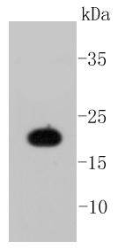 Lane 1: A549 Cells; Probed with Caveolin-1 (9C11) Monoclonal Antibody (bsm-52303R) at 1:1000, overnight at 4°C followed by a conjugated secondary antibody for 60 minutes at 37°C.
