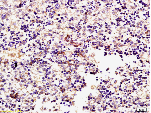 Formalin-fixed and paraffin embedded mouse embryo tissue labeled with Rabbit Anti-ERK1 (Thr203/Tyr205) + ERK2 (Thr183/Tyr185) Polyclonal Antibody, Unconjugated (bs-1522R) at 1:200 followed by conjugation to the secondary antibody and DAB staining