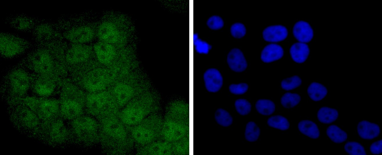 IF(ICC) staining with STAT5A + STAT5B (4C4) Monoclonal Antibody (bsm-52732R) at 1:100 in RH-35 cells (green). The nuclear counterstain is DAPI (blue). Cells were fixed in paraformaldehyde, permeabilized with 0.25% Triton X100/PBS. IF(ICC) staining with STAT5A + STAT5B (4C4) Monoclonal Antibody (bsm-52732R) at 1:100 in RH-35 cells (green). The nuclear counterstain is DAPI (blue). Cells were fixed in paraformaldehyde, permeabilized with 0.25% Triton X100/PBS.