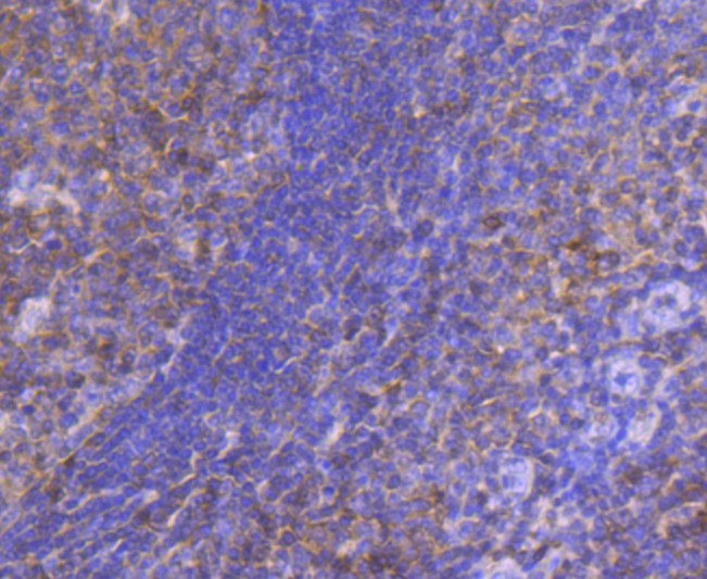 Paraformaldehyde-fixed and paraffin-embedded Human tonsil tissue incubated with STAT5A + STAT5B (4C4) Monoclonal Antibody (bsm-52732R) at 1:100, overnight at 4°C, followed by a conjugated secondary antibody and DAB staining. Counterstained with hematoxylin. Paraformaldehyde-fixed and paraffin-embedded Human tonsil tissue incubated with STAT5A + STAT5B (4C4) Monoclonal Antibody (bsm-52732R) at 1:100, overnight at 4°C, followed by a conjugated secondary antibody and DAB staining. Counterstained with hematoxylin.