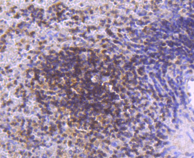 Paraformaldehyde-fixed and paraffin-embedded Human spleen tissue incubated with STAT5A + STAT5B (4C4) Monoclonal Antibody (bsm-52732R) at 1:100, overnight at 4°C, followed by a conjugated secondary antibody and DAB staining. Counterstained with hematoxylin. Paraformaldehyde-fixed and paraffin-embedded Human spleen tissue incubated with STAT5A + STAT5B (4C4) Monoclonal Antibody (bsm-52732R) at 1:100, overnight at 4°C, followed by a conjugated secondary antibody and DAB staining. Counterstained with hematoxylin.
