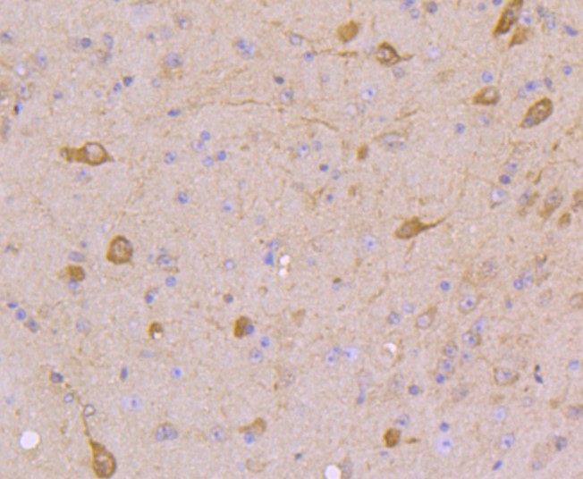 Paraformaldehyde-fixed and paraffin-embedded Mouse brain tissue incubated with STAT5A + STAT5B (4C4) Monoclonal Antibody (bsm-52732R) at 1:100, overnight at 4°C, followed by a conjugated secondary antibody and DAB staining. Counterstained with hematoxylin. Paraformaldehyde-fixed and paraffin-embedded Mouse brain tissue incubated with STAT5A + STAT5B (4C4) Monoclonal Antibody (bsm-52732R) at 1:100, overnight at 4°C, followed by a conjugated secondary antibody and DAB staining. Counterstained with hematoxylin.