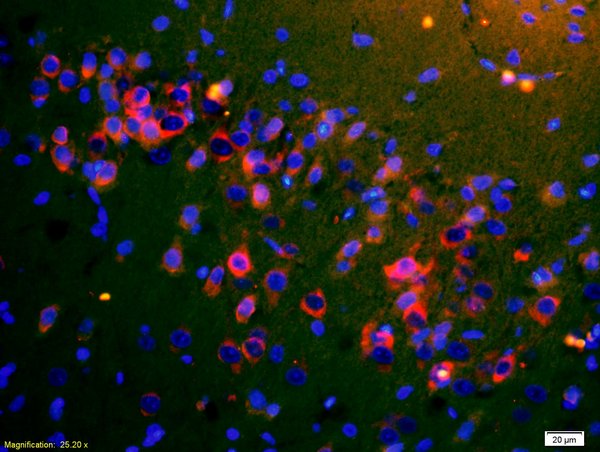 Formalin-fixed and paraffin embedded rat brain carcinoma labeled with Rabbit Anti-ApoA4 Polyclonal Antibody, Unconjugated (bs-2688R) at 1:200 followed by secondary antibody was Goat Anti-Rabbit IgG, Cy3 conjugated (bs-0295G-Cy3) used at 1:200 dilution for 40 minutes at 37°C. DAPI(5ug/ml) was used to stain the cell nuclei