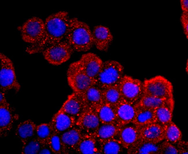 IF(ICC) staining with AQP1 (9C8) Monoclonal Antibody (bsm-52909R) at 1:100 in SW480 cells (red). The nuclear counterstain is DAPI (blue). Cells were fixed in paraformaldehyde, permeabilized with 0.25% Triton X100/PBS.