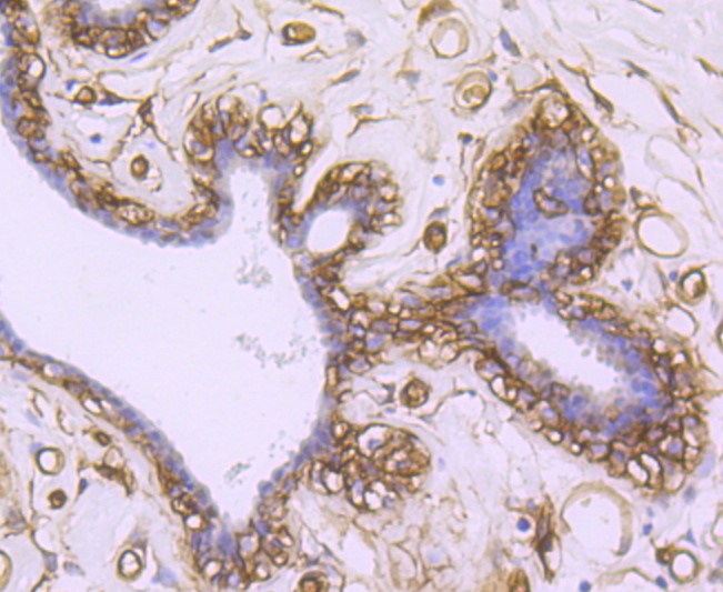 Paraformaldehyde-fixed and paraffin-embedded Human breast tissue incubated with AQP1 (9C8) Monoclonal Antibody (bsm-52909R) at 1:100, overnight at 4°C, followed by a conjugated secondary antibody and DAB staining. Counterstained with hematoxylin.